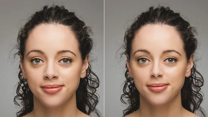 Portrait with softly refined nose and even lighting for a balanced look.